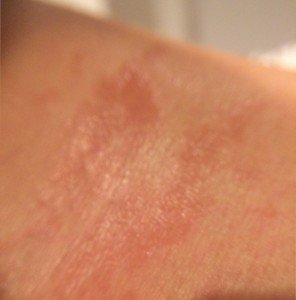 0330sholder2-296x300 - image