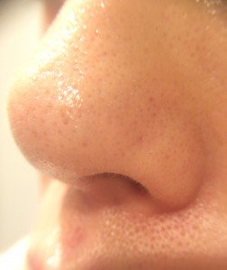 0330nose1-252x300 - image