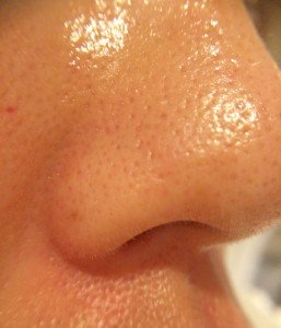 0330nose2-257x300 - image