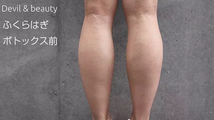 calves-before5 - image
