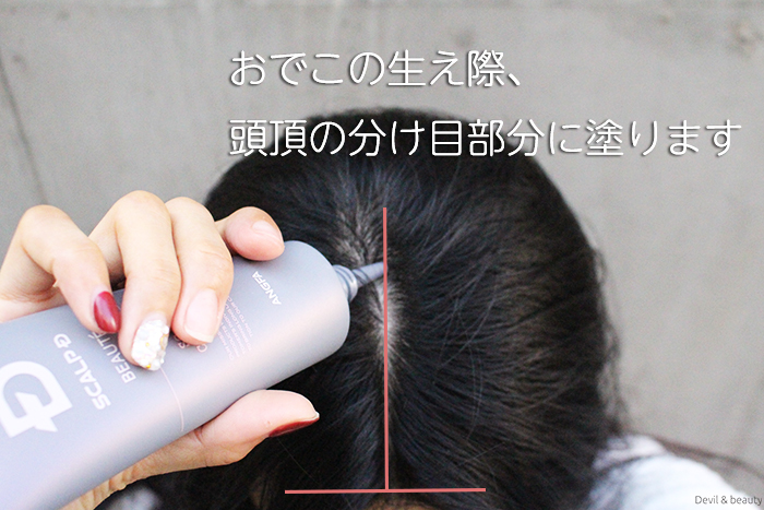 how-to-angfa-scalp-cleanse1 - image