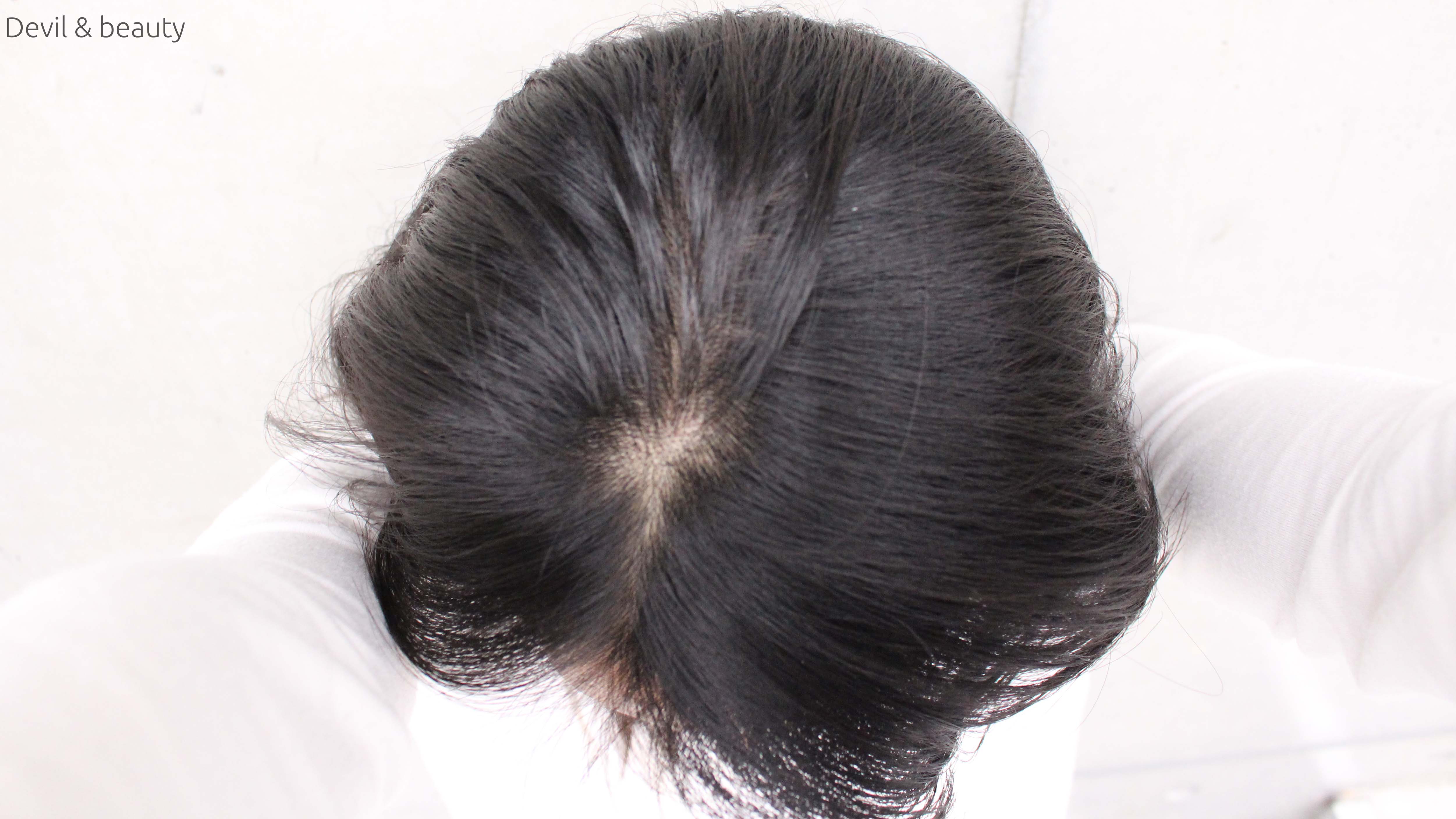 deep-scalp-follicle-volumizer14 - image