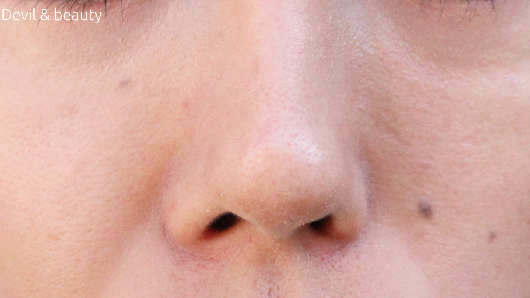 after-l-nose-secreter1 - image