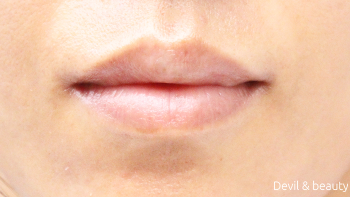 before-use-jane-iredale-just-kissed-lip-plumper - image